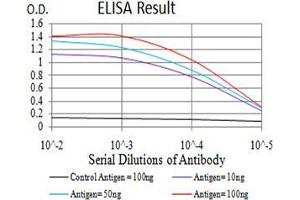 Black line: Control Antigen (100 ng);Purple line: Antigen (10ng); Blue line: Antigen (50 ng); Red line:Antigen (100 ng)