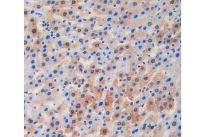 IHC-P analysis of liver tissue, with DAB staining. (LCAT anticorps  (AA 290-434))