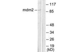 Western blot analysis of extracts from SKOV3 cells, using MDM2 Antibody. (MDM2 anticorps  (AA 391-440))