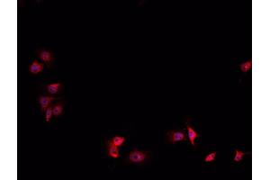 ABIN6267058 staining HeLa cells by IF/ICC. (HIF1A anticorps  (Internal Region))