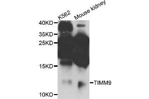 Western blot analysis of extracts of various cell lines, using TIMM9 antibody (ABIN5972654) at 1/1000 dilution. (TIMM9 anticorps)