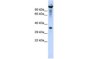 Western Blotting (WB) image for anti-Ribonuclease T2 (RNASET2) antibody (ABIN2458003)