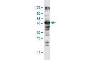 Western Blot detection against Immunogen (47. (MRPL12 anticorps  (AA 1-198))