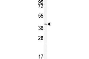 Western blot analysis of SIRT6 antibody and mouse stomach tissue lysate