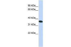 C21ORF59 antibody used at 1 ug/ml to detect target protein. (C21orf59 anticorps  (N-Term))