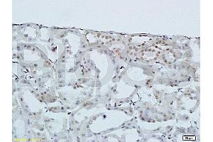 Formalin-fixed and paraffin-embedded: rat kidney tissue labeled with Rabbit Anti-HOXA10 Polyclonal Antibody (ABIN741195) , Unconjugated 1:200 followed by conjugation to the secondary antibody and DAB staining (HOXA10 anticorps  (AA 311-410))