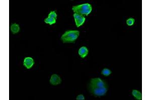 Immunofluorescence staining of MCF-7 cells with ABIN7151218 at 1:200, counter-stained with DAPI. (SIAH2 anticorps  (AA 1-72))