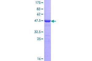 Recoverin (RCVRN) (AA 1-200) protein (GST tag)