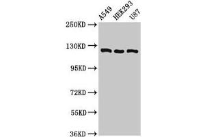 Western Blot Positive WB detected in: A549 whole cell lysate, HEK293 whole cell lysate, U87 whole cell lysate All lanes: ACLY antibody at 8 μg/mL Secondary Goat polyclonal to rabbit IgG at 1/50000 dilution Predicted band size: 121, 120, 92 kDa Observed band size: 121 kDa