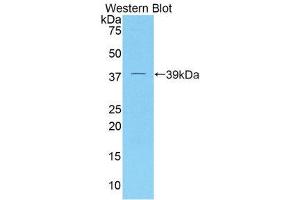 Western Blotting (WB) image for anti-Dickkopf Homolog 4 (Xenopus Laevis) (DKK4) (AA 37-141) antibody (ABIN3202023) (DKK4 anticorps  (AA 37-141))