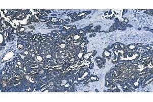 IHC analysis of PCBP2/hnRNP E2 using anti-PCBP2/hnRNP E2 antibody (ABIN7600449). (PCBP2 anticorps  (AA 197-276))