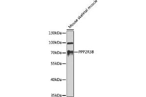 Western blot analysis of extracts of mouse skeletal muscle, using PPP2R3B antibody (ABIN6128489, ABIN6146091, ABIN6146092 and ABIN6224568) at 1:1000 dilution. (PPP2R3B anticorps  (AA 356-575))