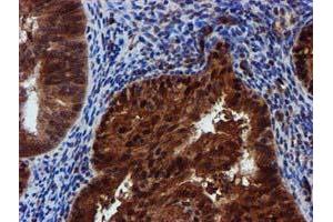 Image no. 7 for anti-Sepiapterin Reductase (SPR) antibody (ABIN1501115)