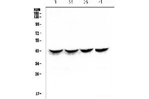 Western blot analysis of Cardiac Troponin T using anti-Cardiac Troponin T antibody (ABIN6719304).