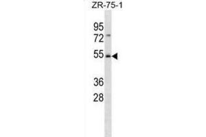 Western Blotting (WB) image for anti-F-Box and WD Repeat Domain Containing 4 (FBXW4) antibody (ABIN3001377) (FBXW4 anticorps)