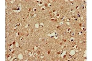 Immunohistochemistry of paraffin-embedded human brain tissue using ABIN7155835 at dilution of 1:100