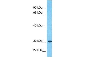 Host:  Rabbit  Target Name:  MDFI  Sample Type:  RPMI-8226 Whole Cell lysates  Antibody Dilution:  1. (MDFI anticorps  (Middle Region))