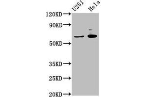 Western Blot Positive WB detected in: U251 whole cell lysate, Hela whole cell lysate All lanes: GABRA4 antibody at 7 μg/mL Secondary Goat polyclonal to rabbit IgG at 1/50000 dilution Predicted band size: 62 kDa Observed band size: 62 kDa (GABRA4 anticorps  (AA 36-258))