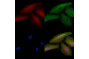 ABIN6264925 and ABIN6278520 staining  cells by IF/ICC. (SGCB anticorps  (N-Term))