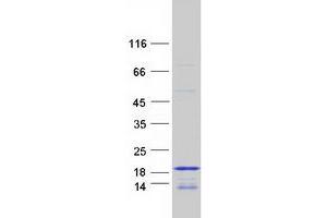 Validation with Western Blot