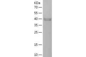Western Blotting (WB) image for Phospholipase A2-Activating Protein (PLAA) (AA 621-795) protein (His-IF2DI Tag) (ABIN7124427)