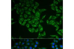Immunofluorescence analysis of A549 cells using CD247 Polyclonal Antibody