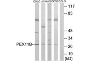 Western blot analysis of extracts from COLO/HuvEc/COS7/Jurkat cells, using PEX11B Antibody. (PEX11B anticorps  (AA 91-140))