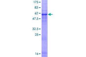 Image no. 1 for Regulator of Chromosome Condensation (RCC1) and BTB (POZ) Domain Containing Protein 1 (RCBTB1) (AA 1-355) protein (GST tag) (ABIN1317682)