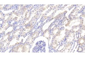Detection of LEP in Bovine Kidney Tissue using Polyclonal Antibody to Leptin (LEP) (Leptin anticorps  (AA 29-160))