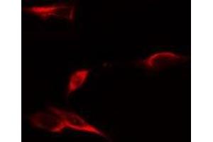ABIN6275061 staining LOVO cells by IF/ICC. (DPYSL4 anticorps  (Internal Region))