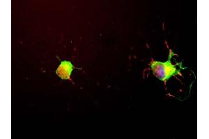 We obtained Neuromics E18 hippocampal neurons and grew them for seven days following the Neuromics protocol.