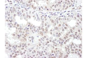 Immunohistochemistry (IHC) image for anti-NFKB Repressing Factor (NKRF) (AA 50-100) antibody (ABIN7455003)