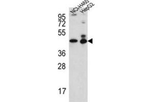 Western Blotting (WB) image for anti-Actin-Like 6B (ACTL6B) antibody (ABIN3002303)