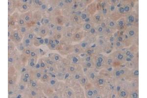 DAB staining on IHC-P; Samples: Mouse Liver Tissue (SGK3 anticorps  (AA 141-368))