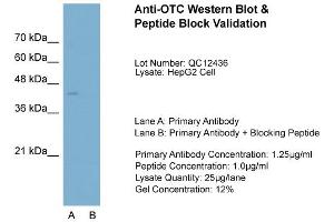 Host:  Rabbit  Target Name:  OTC  Sample Type:  HepG2  Lane A:  Primary Antibody  Lane B:  Primary Antibody + Blocking Peptide  Primary Antibody Concentration:  1. (OTC anticorps  (N-Term))