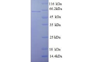 SDS-PAGE (SDS) image for Dihydrolipoyl Transacetylase (DLAT) (AA 93-640), (partial) protein (His tag) (ABIN5709403)