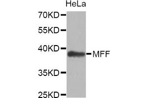 Western blot analysis of extracts of HeLa cell line, using MFF antibody. (MFF anticorps)