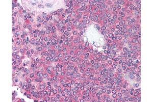 Anti-CD10 antibody IHC of human spleen.