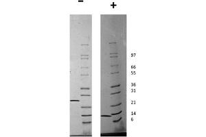 SDS-PAGE of Human Artemin Recombinant Protein SDS-PAGE of Human Artemin Recombinant Protein.