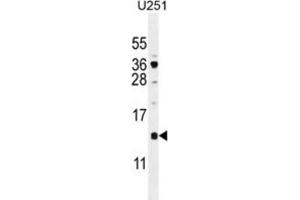Western Blotting (WB) image for anti-SFT2 Domain Containing 2 (SFT2D2) antibody (ABIN2996054)