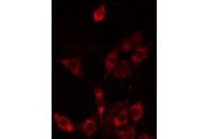 ABIN6275240 staining HepG2 by IF/ICC. (SLC25A21 anticorps  (Internal Region))