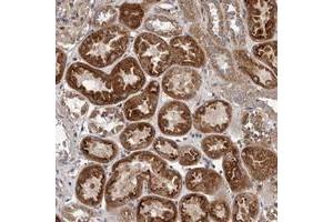 Immunohistochemical staining of human kidney with VPS37A polyclonal antibody  shows strong cytoplasmic positivity in tubular cells. (VPS37A anticorps)