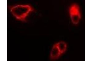 Immunofluorescent analysis of GAS2 staining in SW620 cells.