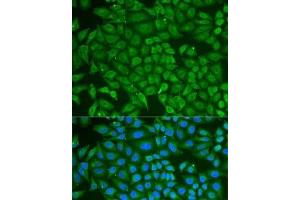 Immunofluorescence analysis of U2OS cells using PIP Polyclonal Antibody (PIP anticorps)