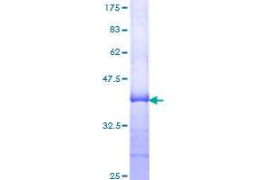 Image no. 1 for Carnitine Palmitoyltransferase 2 (CPT2) (AA 351-450) protein (GST tag) (ABIN1350253)