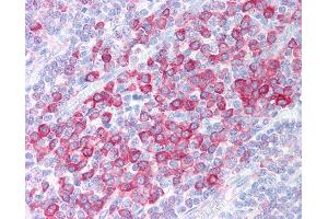 Anti-C1QTNF4 / CTRP4 antibody IHC of human tonsil. (C1QTNF4 anticorps  (C-Term))