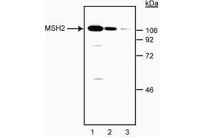 Western blot analysis of MSH-2. (MSH2 anticorps)