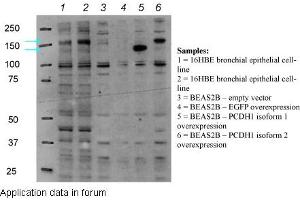 PCDH1 antibody - N-terminal region  validated by WB using bronchial epithelial cell line (16HBE)