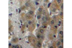 Used in DAB staining on fromalin fixed paraffin-embedded Liver tissue (Fatty Acid Synthase anticorps  (AA 26-78))