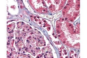 Anti-GFPT1 antibody IHC of human kidney.